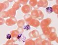 malaria microscopic